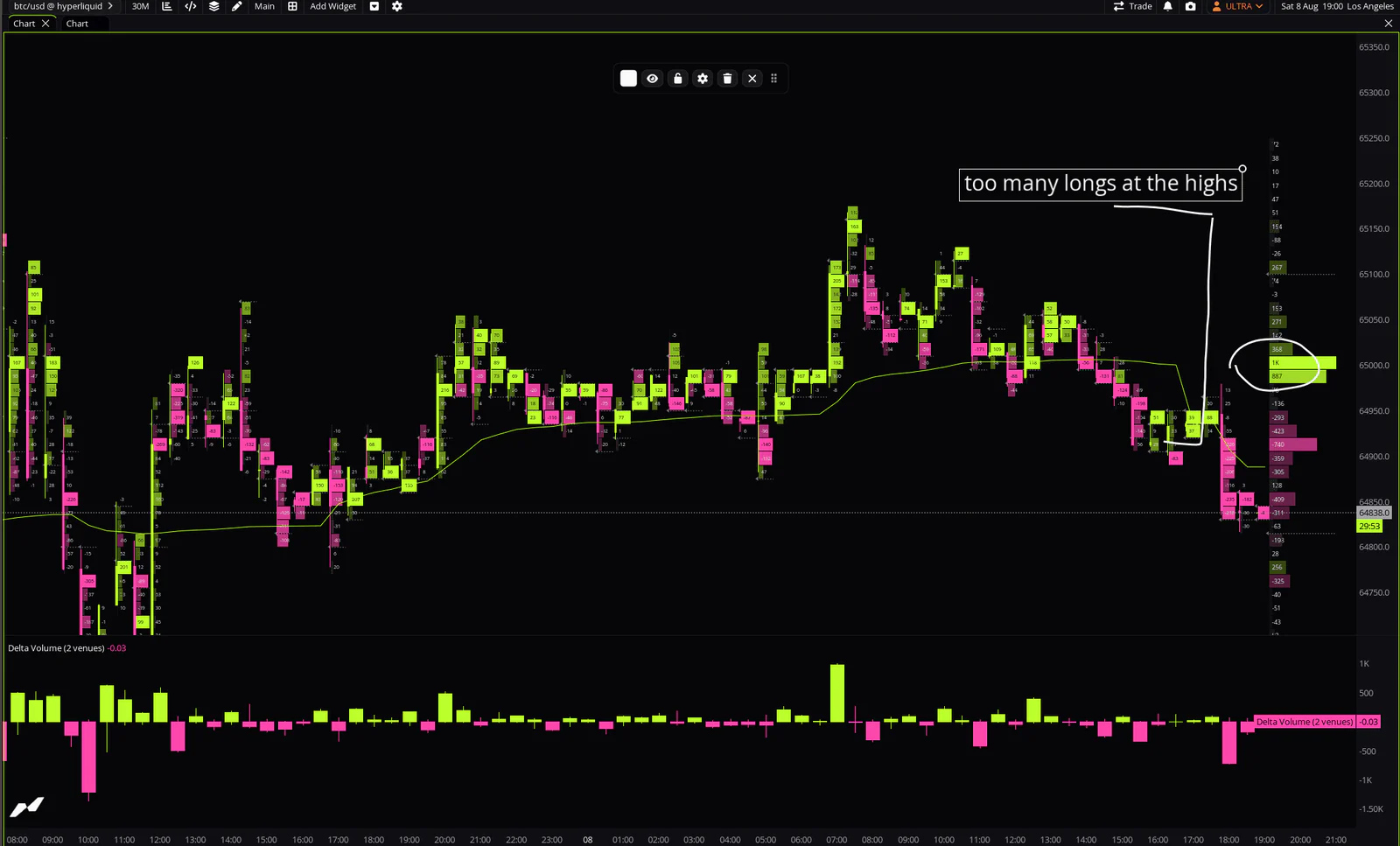 The sessions, and the charts we read together — 4 of 5